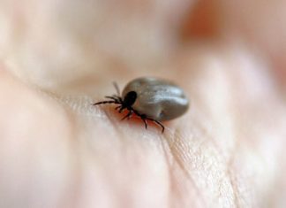 encefalite da zecca