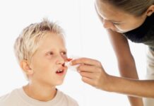 Sangue dal naso bambini o epistassi, quando preoccuparsi?