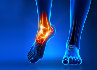 dolore alla caviglia