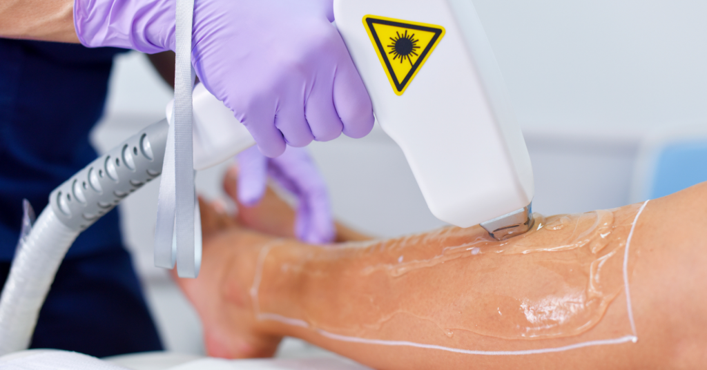 I benefici dell’epilazione laser diodi, trattamento definitivo e indolore, sicuro per la salute